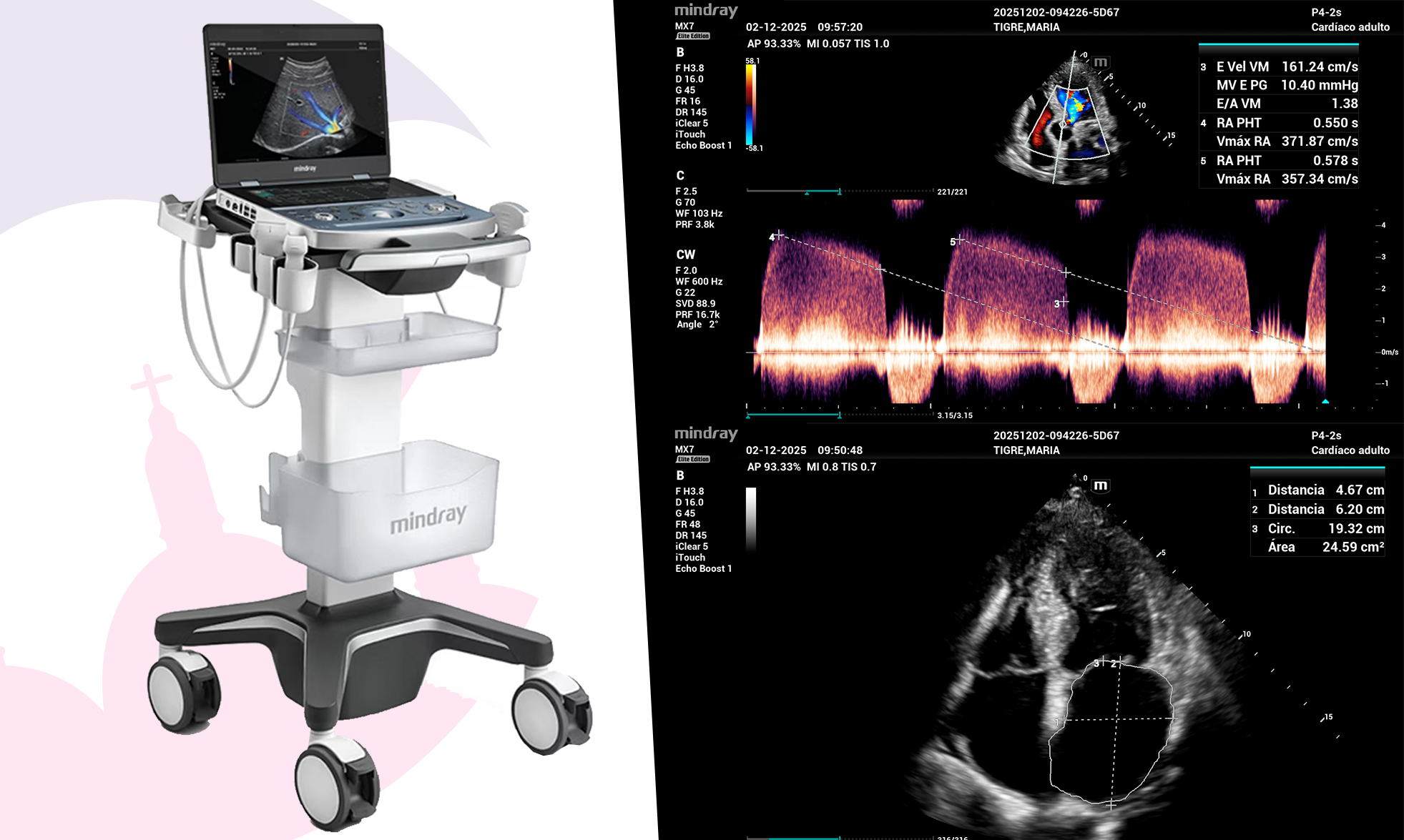 Equipo médico en acción